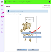 MOBILE-4587_iPad_overlap_Tibia.png